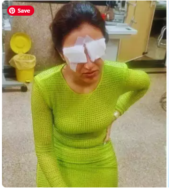 Jasmin Bhasin eye injury